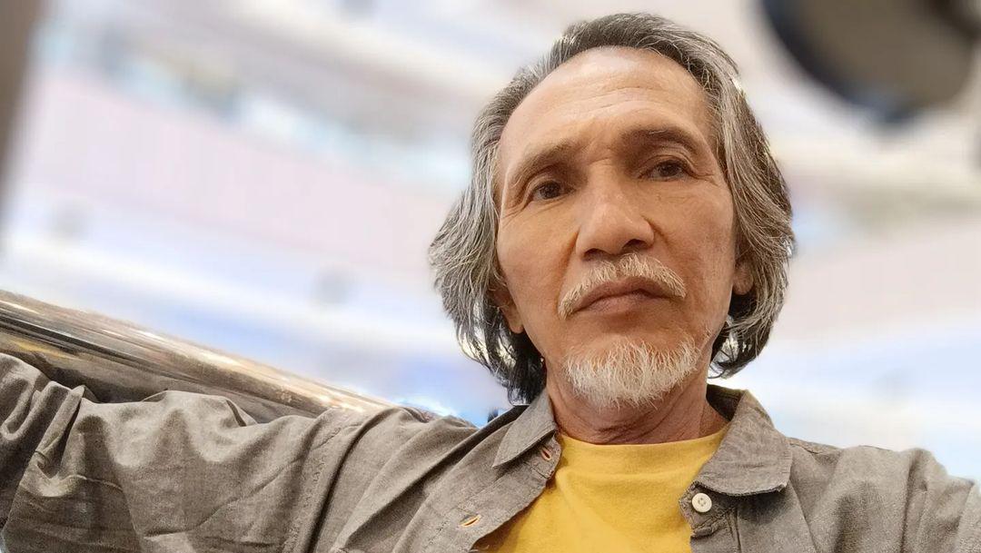 Soal Kanker Rektum yang Diidap Aktor Otig Pakis Sebelum Meninggal