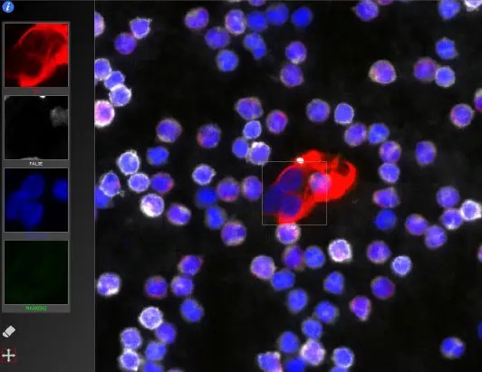 Microscopic image of a cervical cancer stem cell