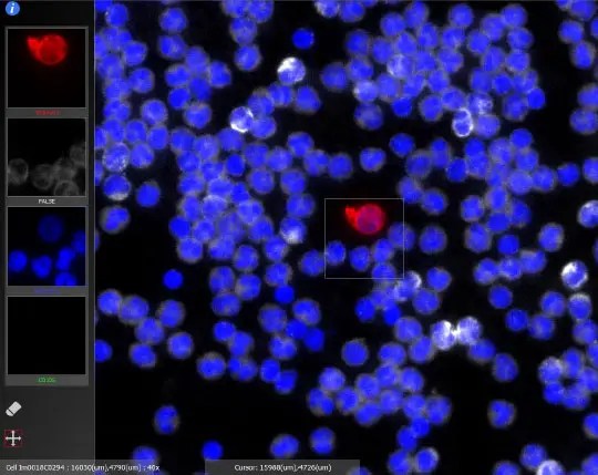 Alternate prostate circulating tumor cell image