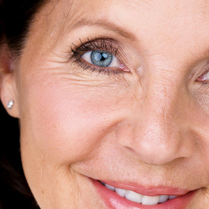 Blépharoplastie 