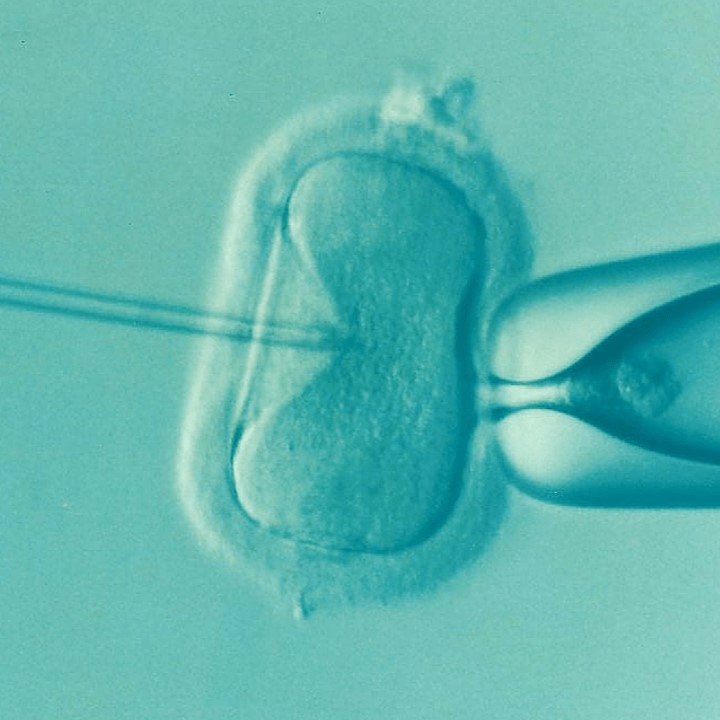 IVF