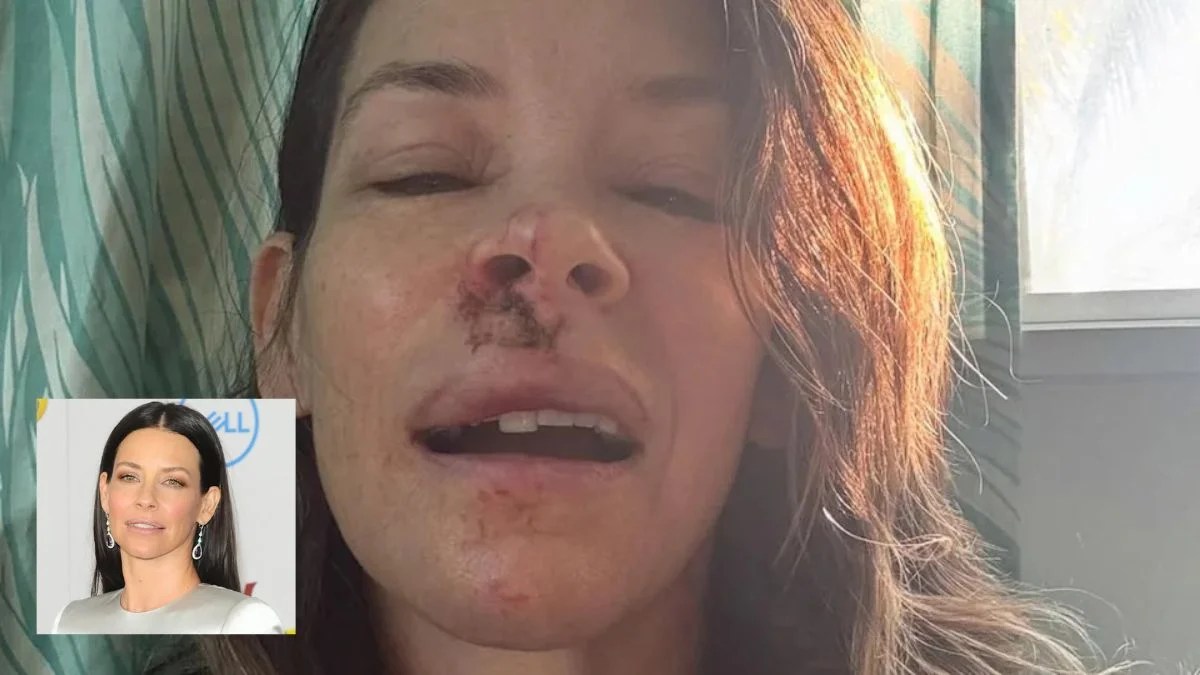 Evangeline Lilly Reveals Lasting Brain Injury After Hawaii Accident: Actress Shares Honest Health Update in 2026