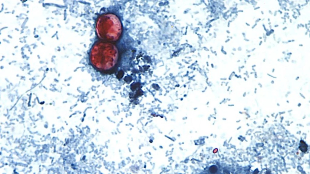 Microscopic view of spherical Cyclospora cayetanensis oocysts stained bright pink-red on a modified acid-fast stool smear.