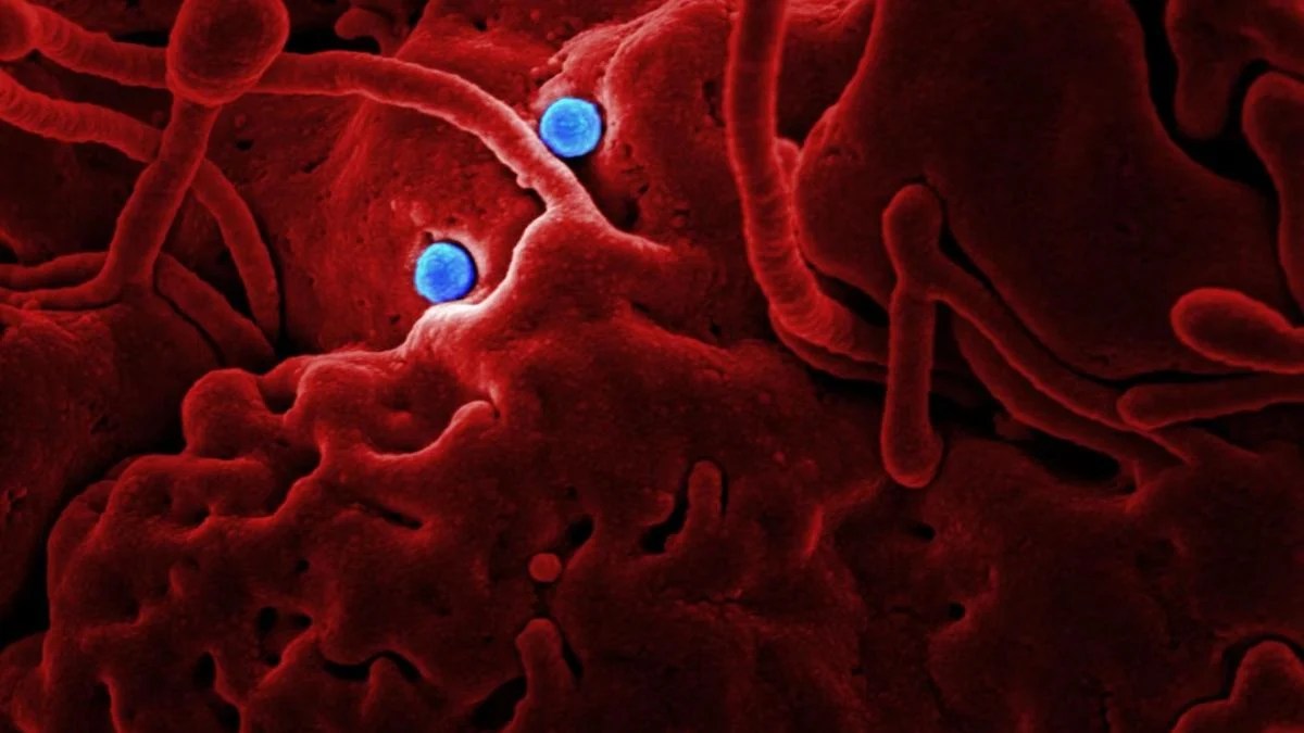 Viral Freemason Whistleblower Prediction Sparks Plague Fears After Russian Lab Worker’s Death — What WHO Actually Found