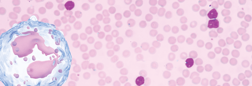 Peut en plus faire de la fièvre et avoir des maux de ventre;; Atteintes Gastro Intestinales A Eosinophiles Societe Gastro Intestinale Www Mauxdeventre Org