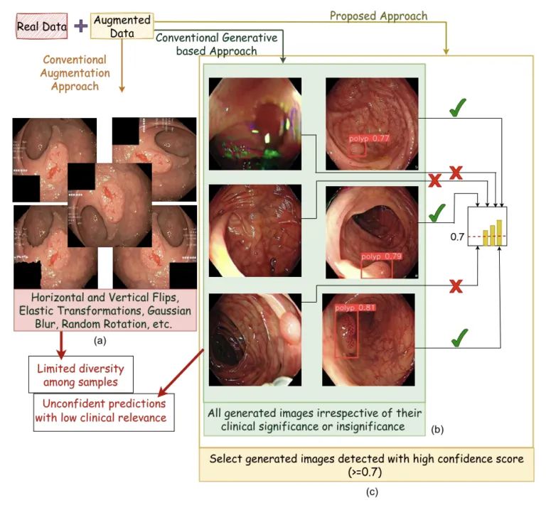 Polyp Segmentation Of Colonoscopy Images Using Modified Polyp Seg Net Model Super Resolution - Best Space Arts in HD