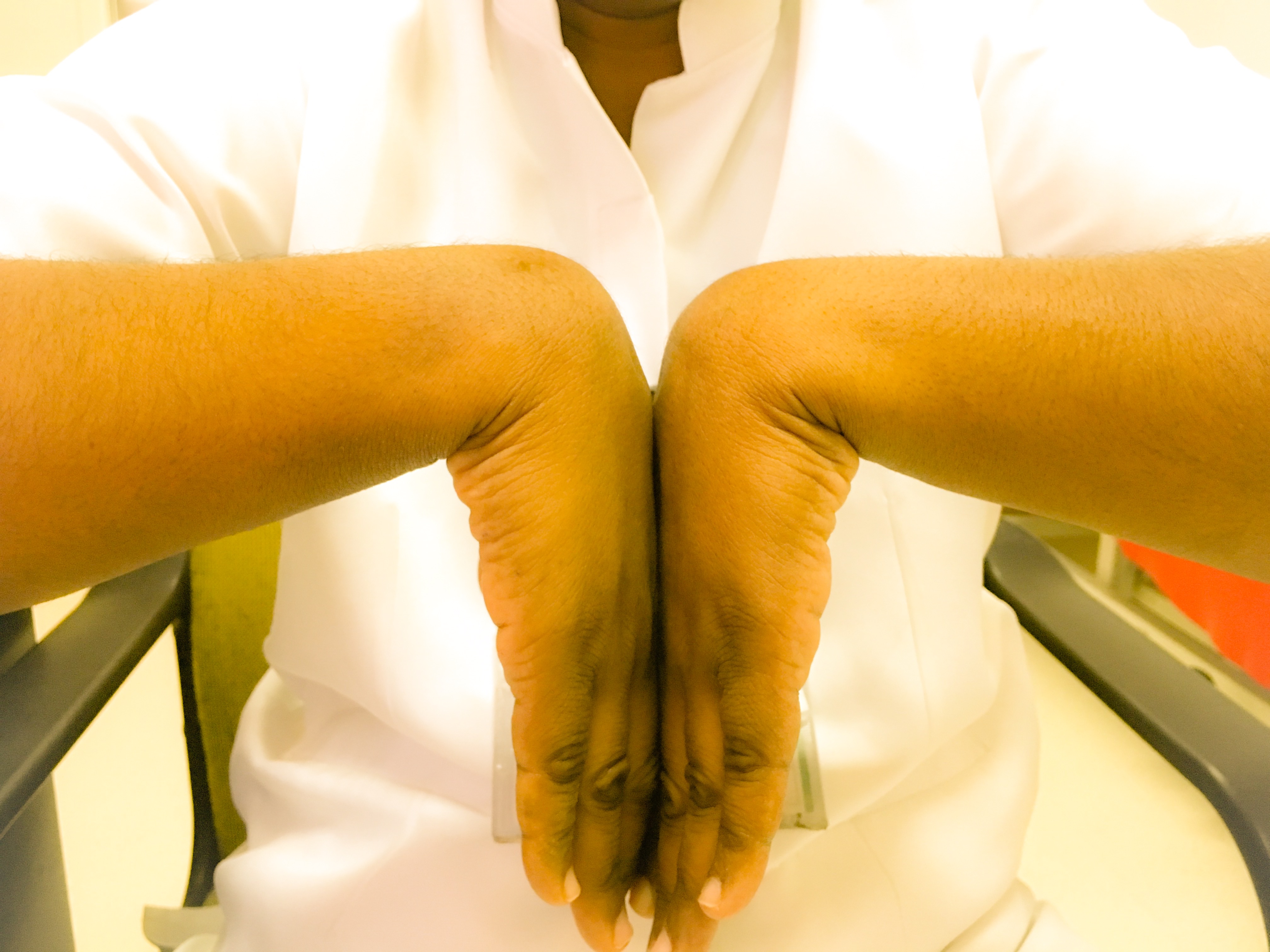 WRIST PLANTARFLEXION