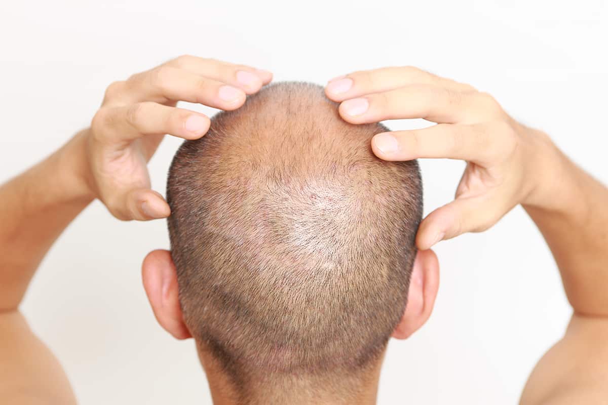 12 [best] bald head moisturizers & lotions