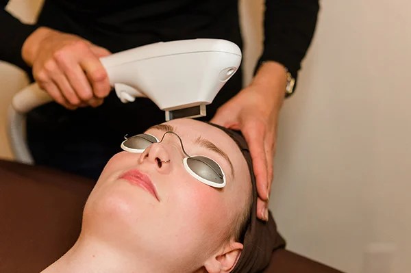 IPL and laser resurfacing