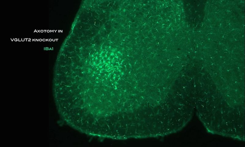 Allan Basbaum Phd Basbaum Lab - Landscape Image Collection - Retina Quality