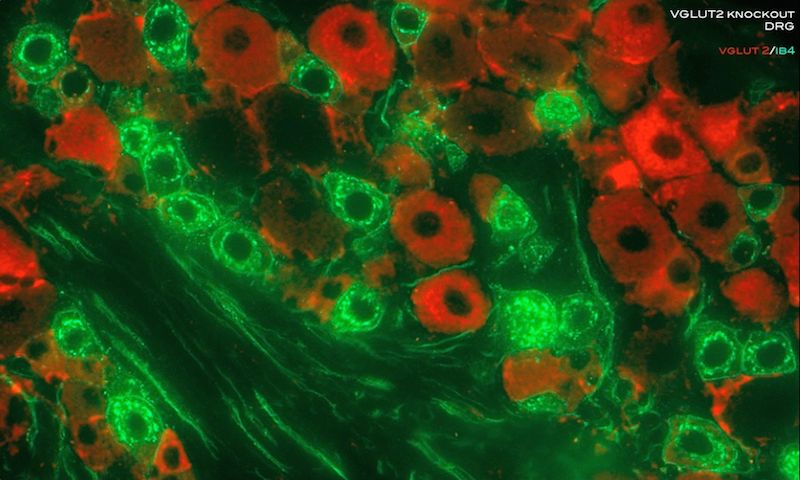 Basbaum Lab Ucsf - Best Landscape Designs in Retina