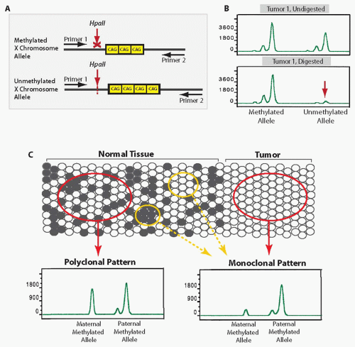 Principles of Molecular Diagnostics in Thyroid Samples | Basicmedical Key