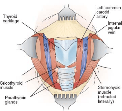 Lymph Node Dissections of the Neck | Basicmedical Key