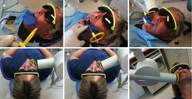 Endodontic Radiology | Basicmedical Key
