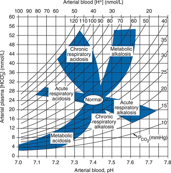 Fluid and Electrolyte Imbalances and AcidBase Disturbances Case