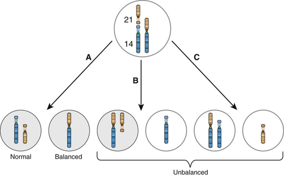 Aneuploidy Basicmedical Key