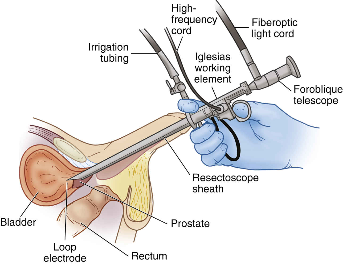 Surgery | Basicmedical Key