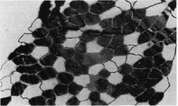 A114622_2_En_5_Fig10_HTML.gif