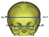 A329170_1_En_9_Figd_HTML.gif