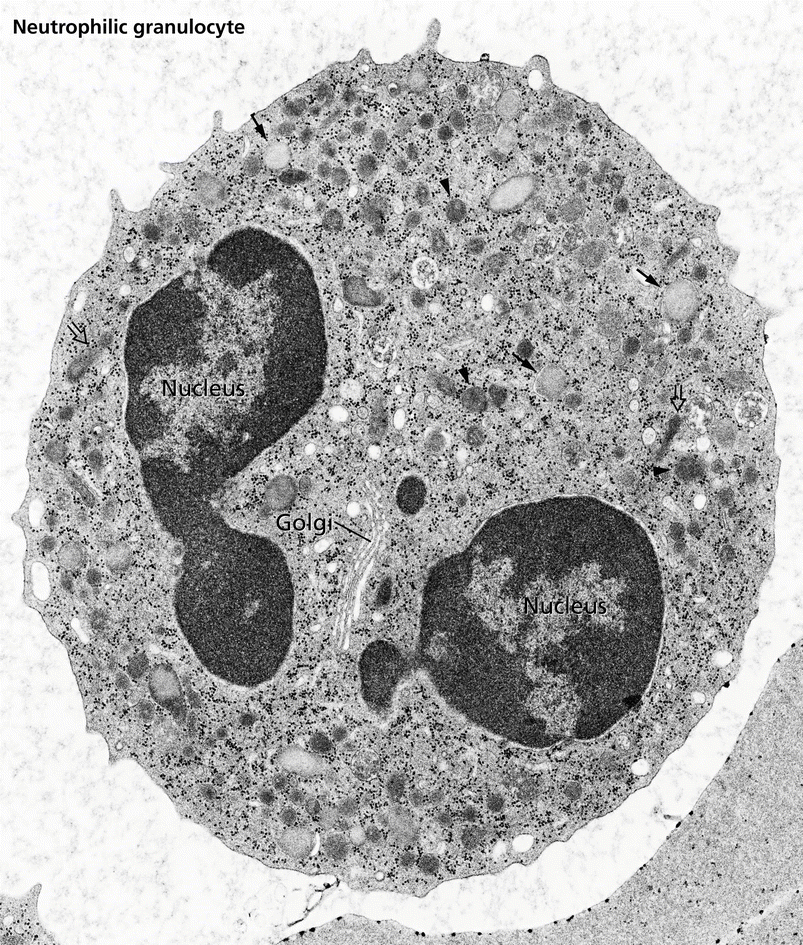 A65917_3_En_30_Fig2_HTML.gif