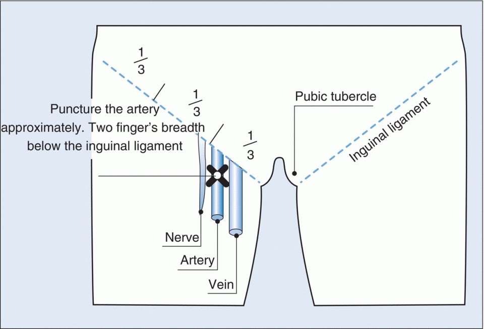 c13-fig-0002