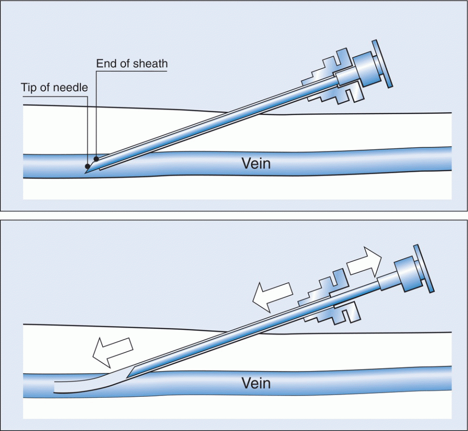c13-fig-0003