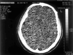 //bbspot.com/Images/News_Features/2003/06/corked_brain.jpg' cannot be displayed]