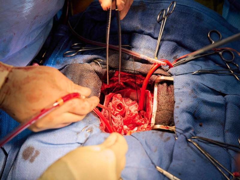 New testing has raised hopes for pig organ transplants to save lives.