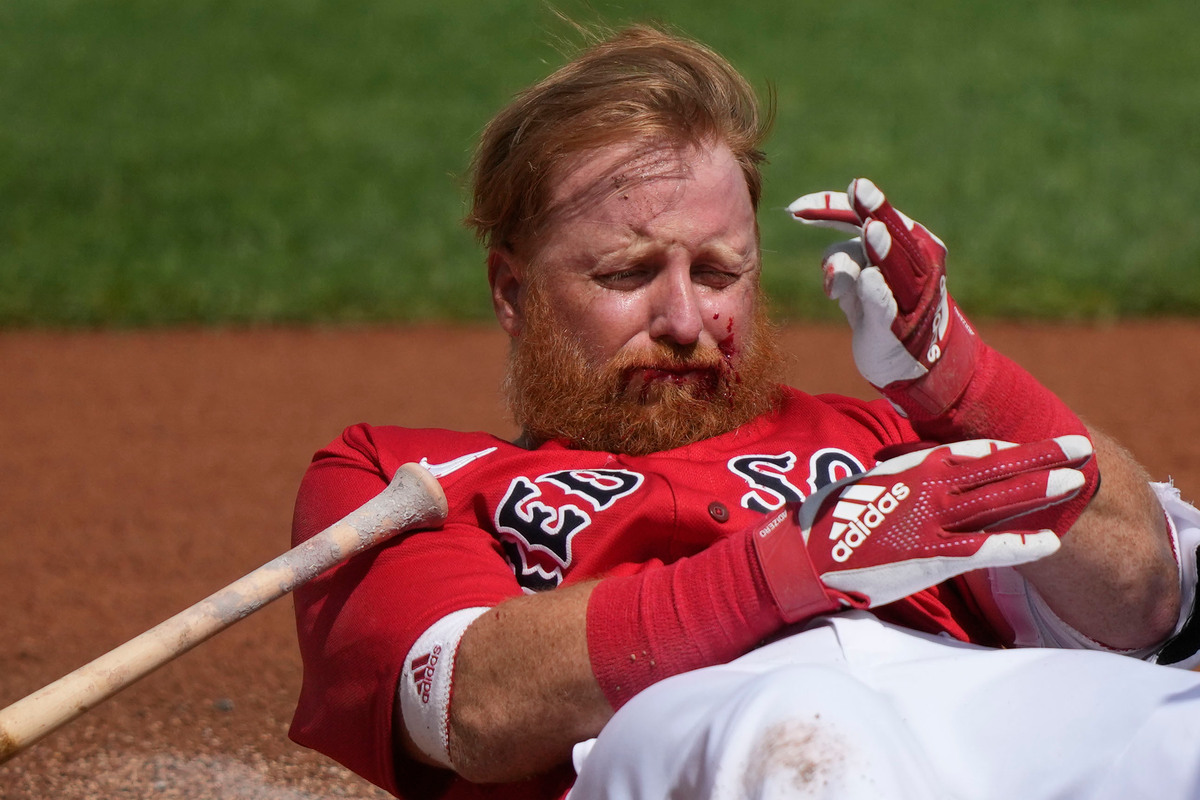 Justin Turner needed 16 stitches after getting drilled by right-hander Matt Manning.