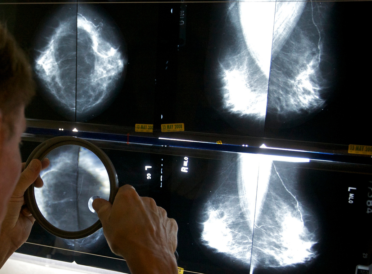 Jean Hay Bright writes that mammograms are woefully, and dangerously, inadequate for many women.