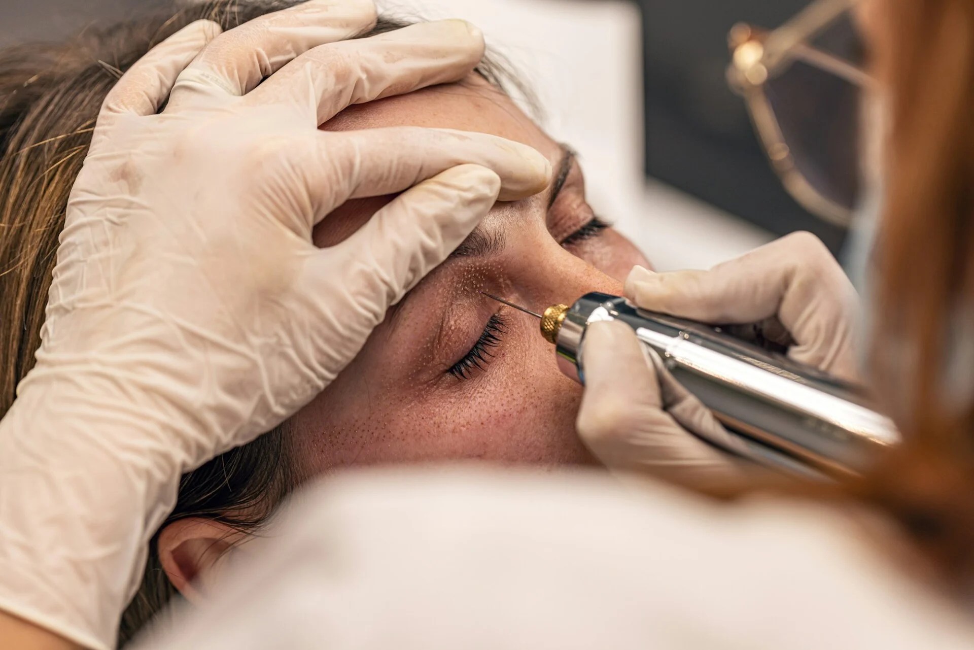 Nonsurgical cosmetic procedures