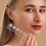 How do pimple patches work
