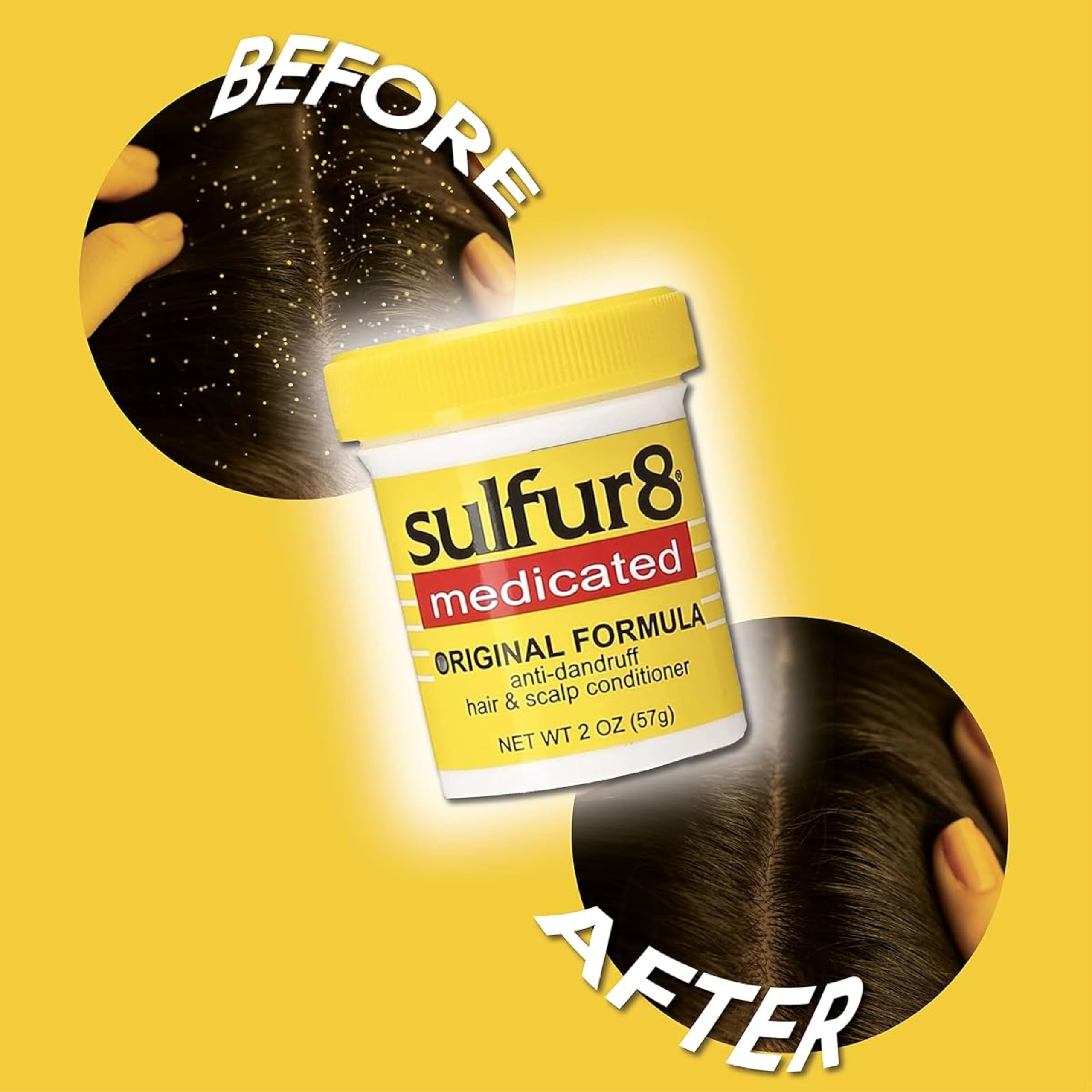 Sulfur8 Medicated Original Formula Anti-Dandruff Hair And Scalp Conditioner, 2 OZ