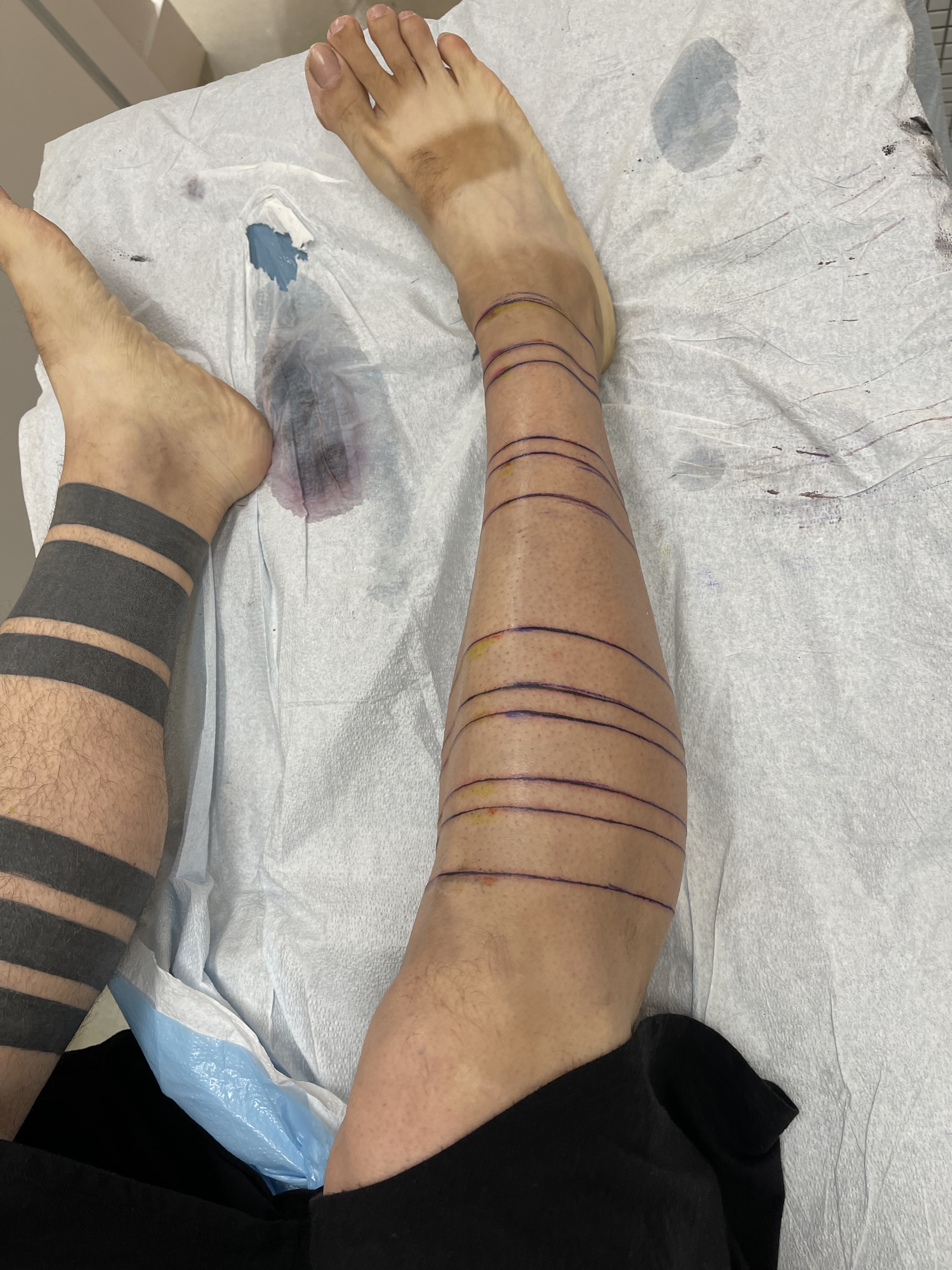 My Tattooing