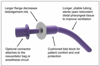 New Distal Pharyngeal Airway Contributes to Improved Patient Care and Outcomes: 2 Case Reports