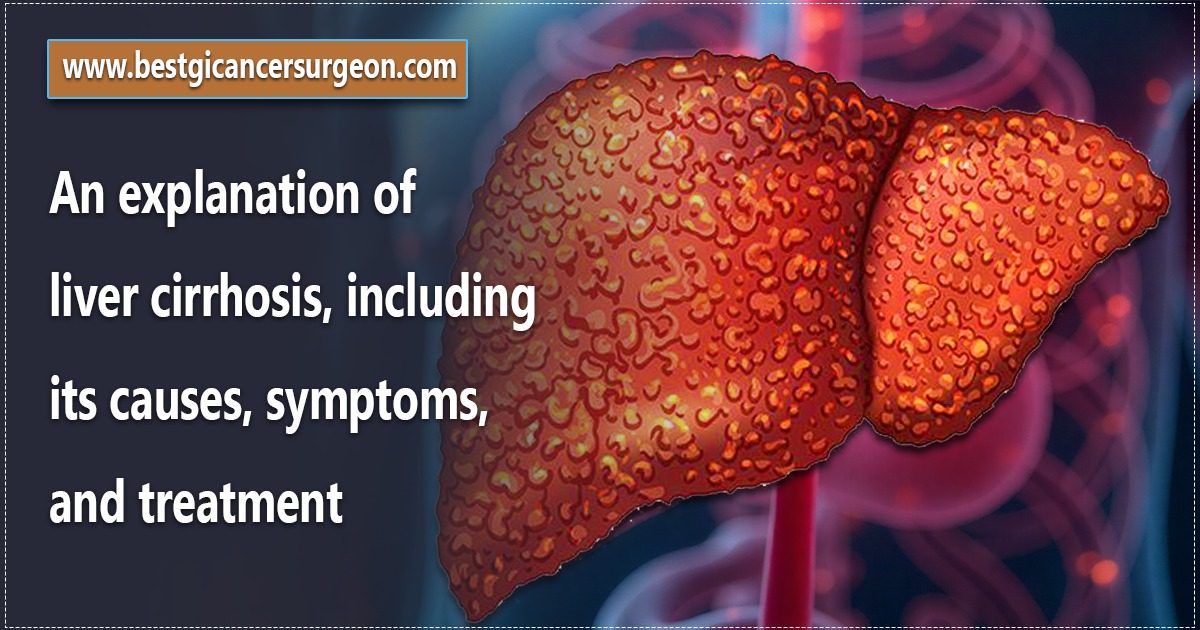 liver cirrhosis by dr. suddhasattwa sen
