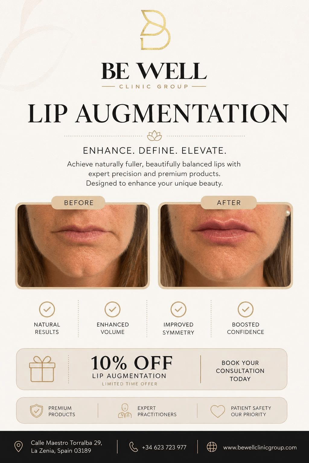 Lip Augmentation before and after results at Be Well Clinic Group in La Zenia.