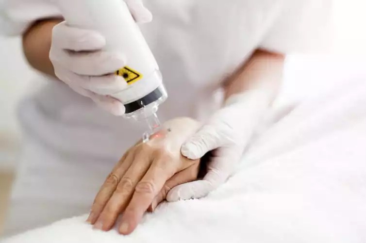 Example of Laser Skin Resurfacing treatment.