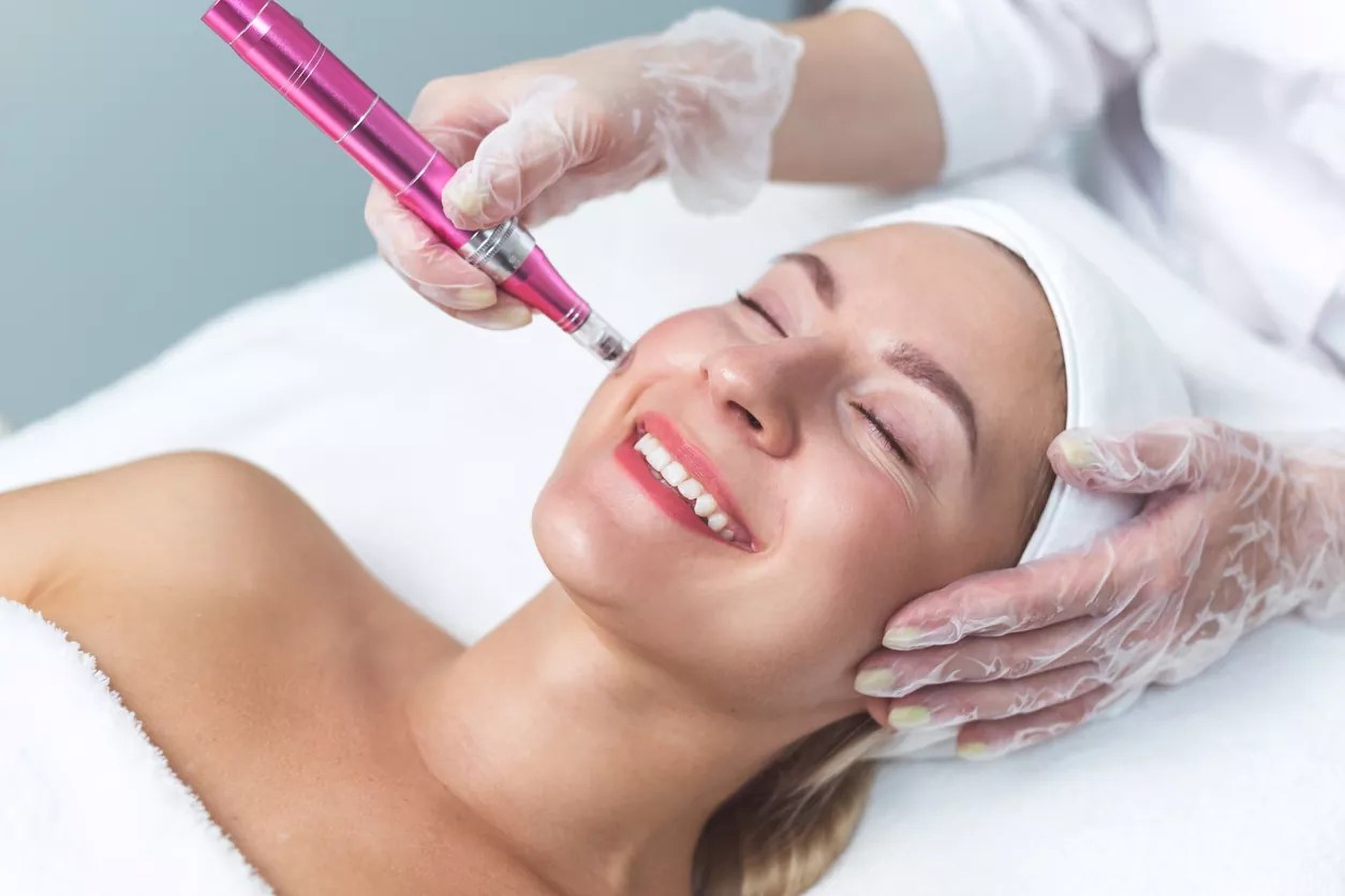 microneedling treatment benefits