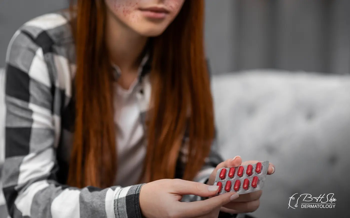 Accutane Treatment for Acne. The patient is taking isotretinoin capsules for severe, persistent acne.