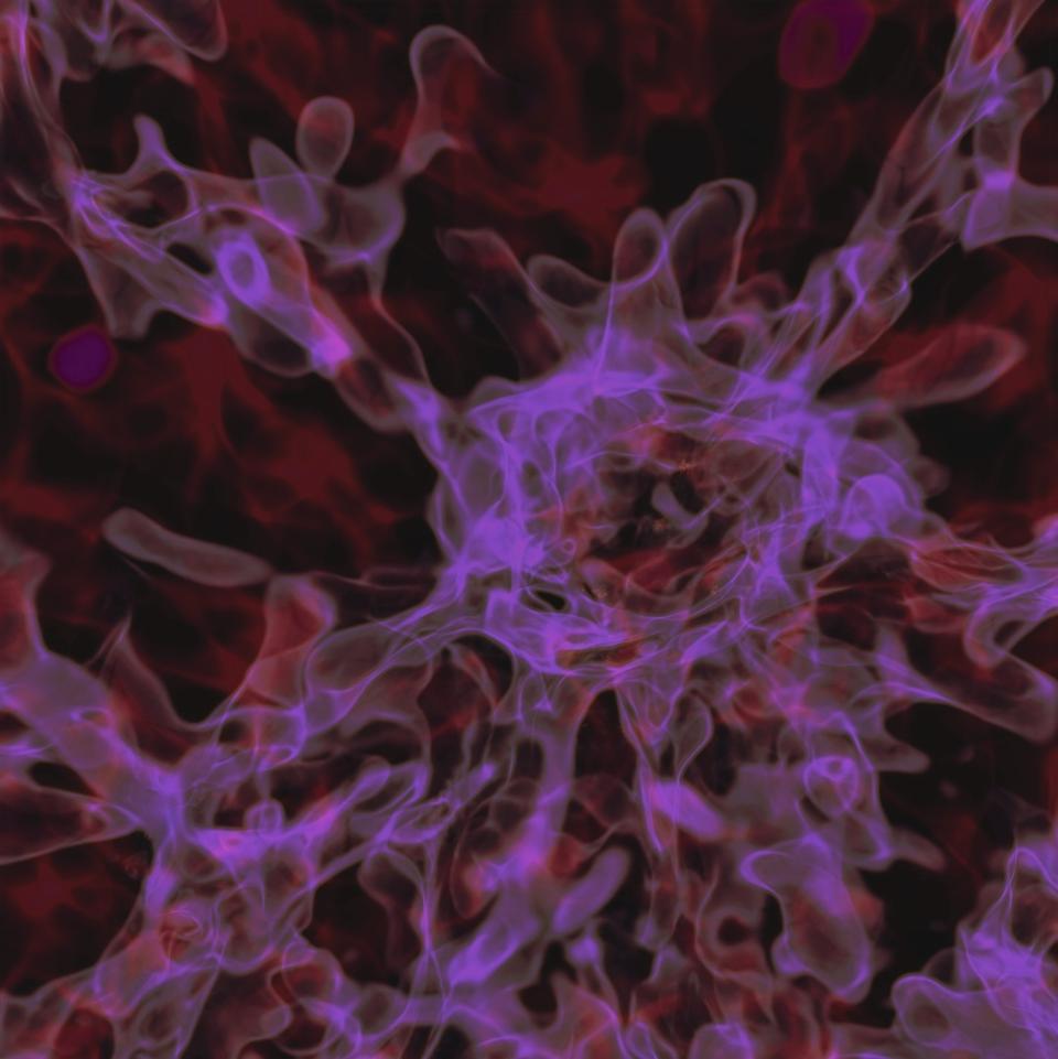 primordial black holes