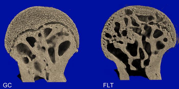 37-Day microgravity exposure in 16-Week female C57BL/6J mice is associated with bone loss specific to weight-bearing skeletal sites