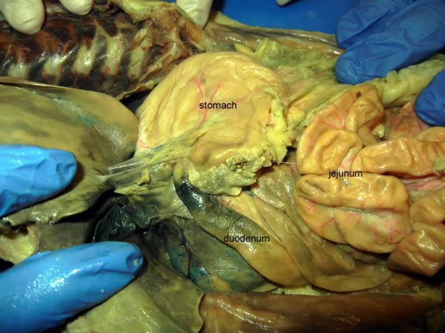04.10.2021 · the vermiform appendix is a blind lymphoid pouch located in the right iliac fossa which arises from the cecum. Cat Dissection