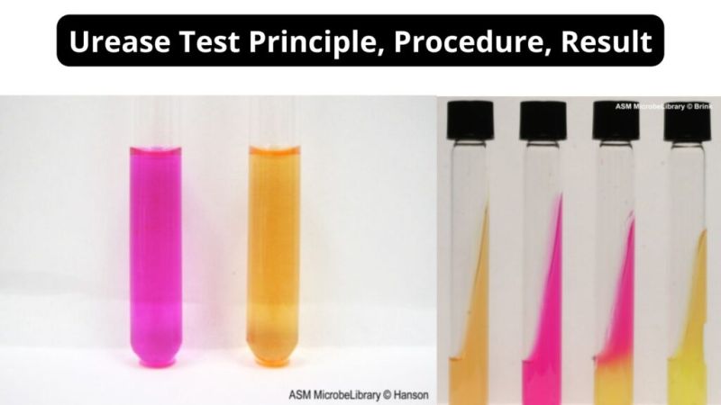 Simmons Citrate Agar Test Procedure Principle Result Example - Download Modern Nature Wallpaper | HD