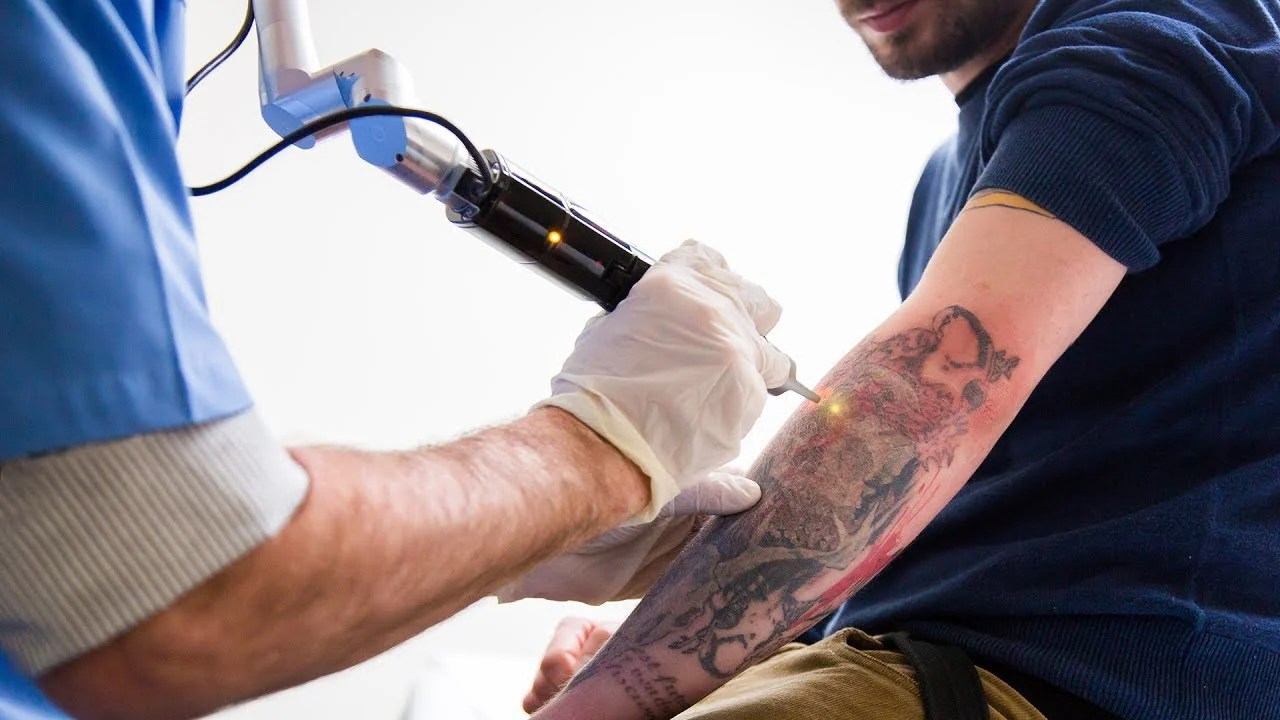 Un Tatuaggio È Per Sempre, Ma Perché? 720_x_1280_jpg