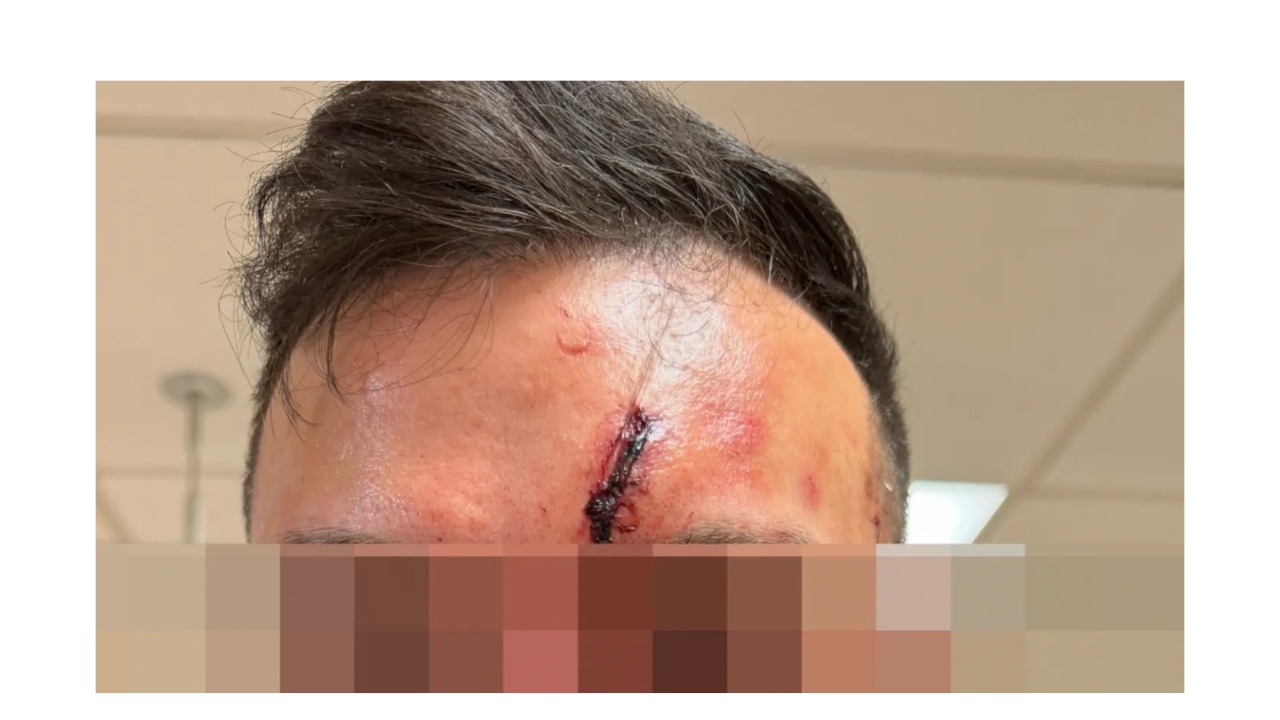 CASE STUDY | A Violent Home Invasion Shows the Human Cost of ‘Crypto Wrench Attacks’