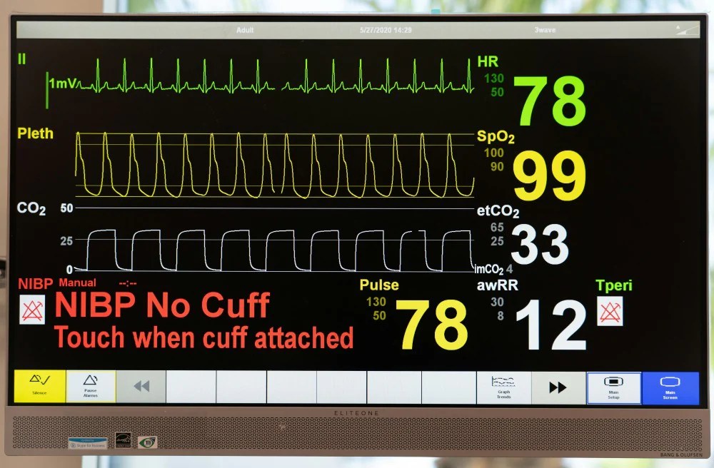 How To Monitor Your Blood Pressure Without A Device You Need Read It