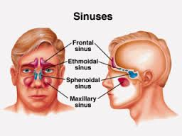 Obat Herbal Sinusitis Alami Softbank Robotics Community
