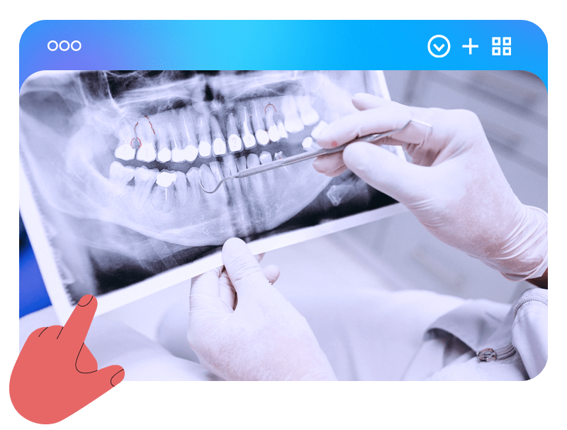 Dentista analisando raio-X odontológico para avaliação da saúde bucal e planejamento de tratamento dentário.