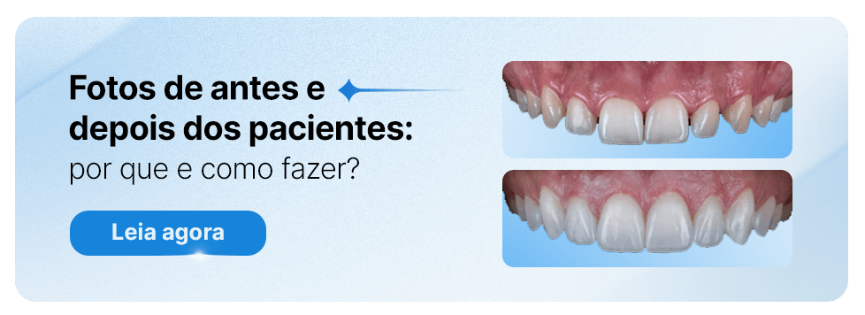 Imagem comparativa mostrando fotos de antes e depois dos pacientes com foco em tratamentos odontológicos, destacando melhorias na aparência dos dentes.